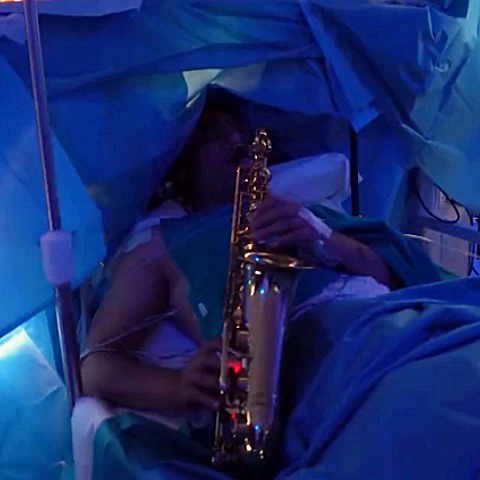 Doctor removed brain tumor while patient playing saxophone