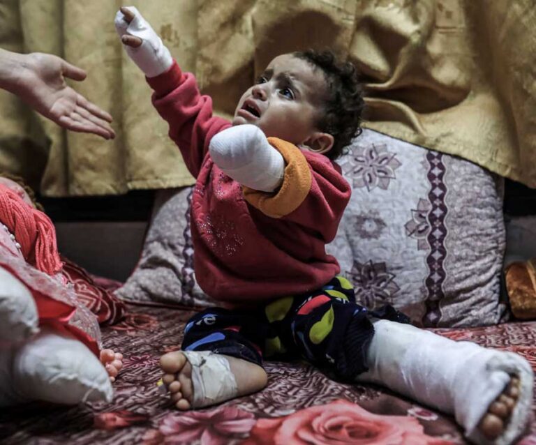 NUMBER OF AMPUTEES SET TO RISE IN GAZA AS ISRAEL BLOCKS AID, NGO WARNS